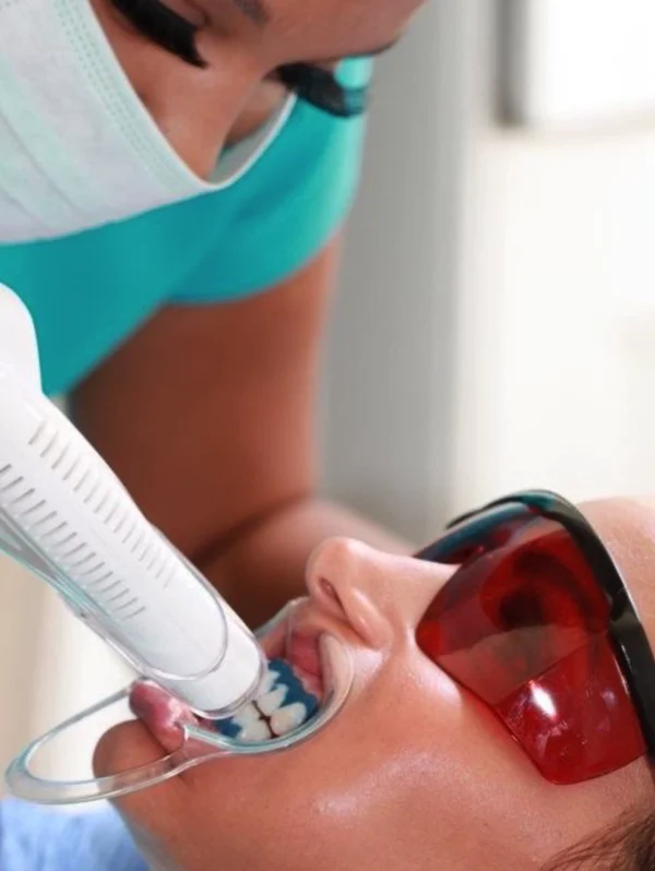 Blanchiment dentaire