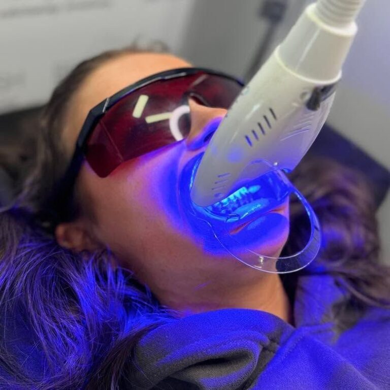 Blanchiment dentaire